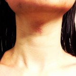 strange red rash on throat